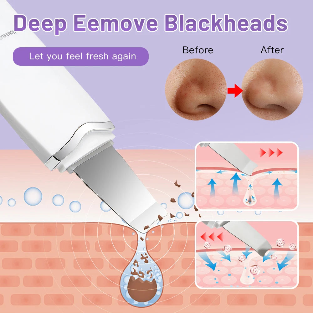 Espátula facial ultrasónica de limpieza profunda