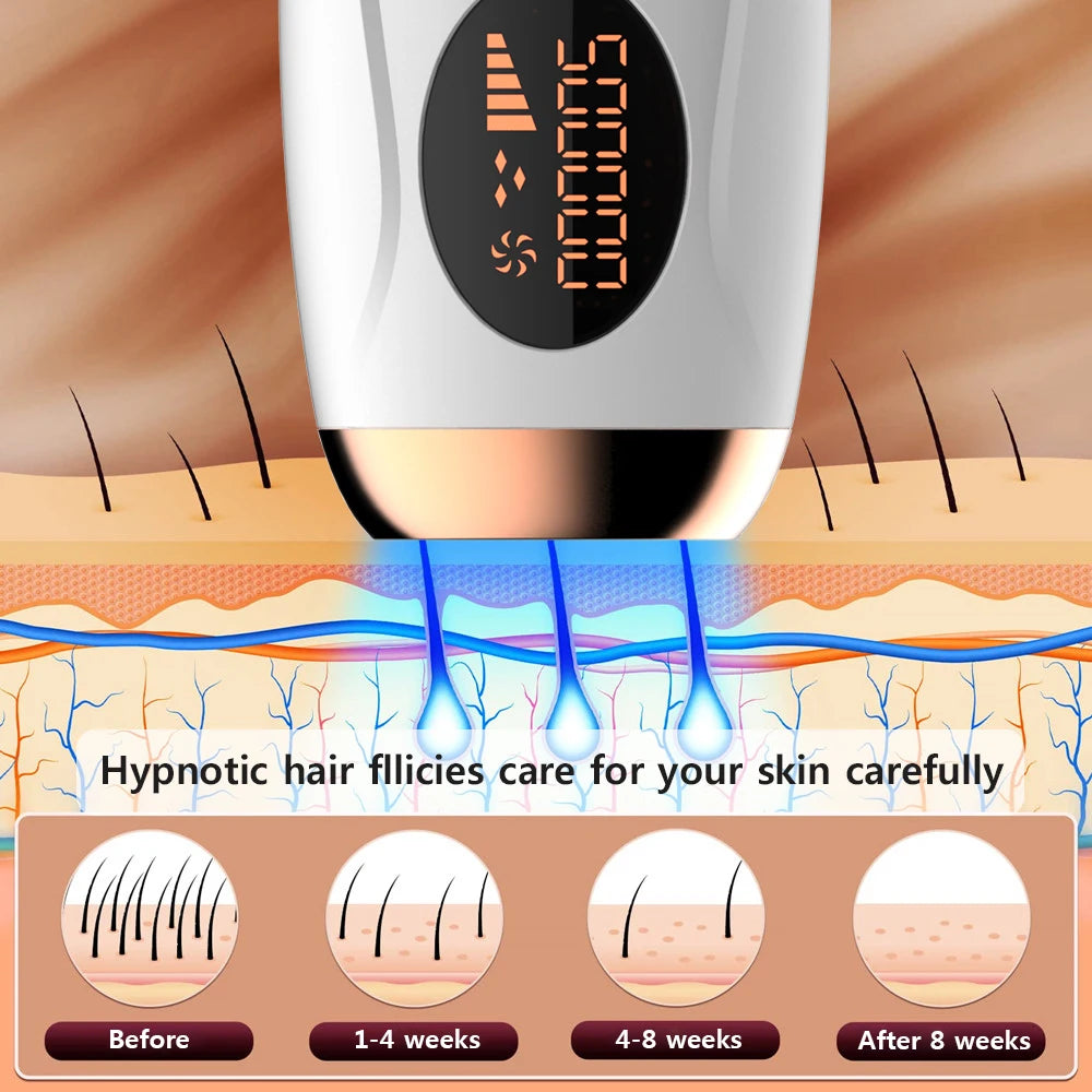 Depiladora de luz pulsada IPL para casa